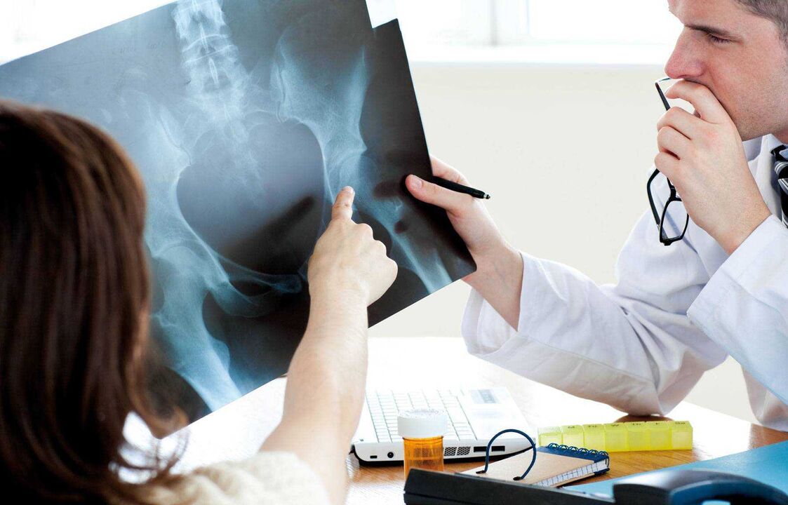 doctors who x-ray the hip arthrosis
