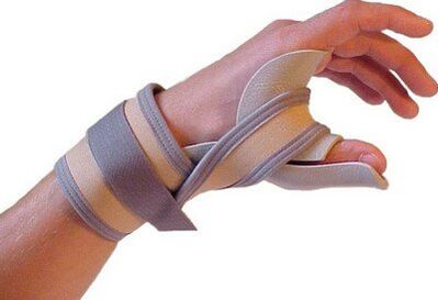 Fixation of the thumb arm for injuries